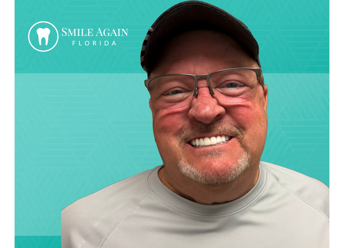 smile-again-web-before-after-unamed1